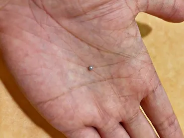 サイゼリヤのムール貝から真珠！？SNSで話題沸騰！真珠発見の顛末と、その背景(？)サイゼリヤのムール貝から真珠が出現！