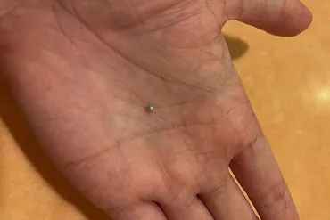 サイゼリヤでムール貝食べたら」→噛んだときに違和感…まさかの体験に31万゛いいね゛ 口の中から発見されたものとは 